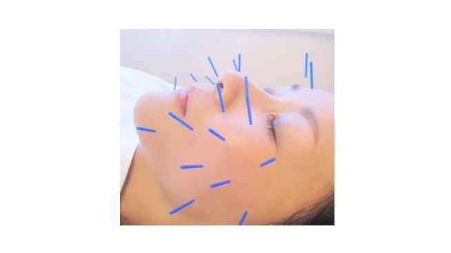 小顔あご